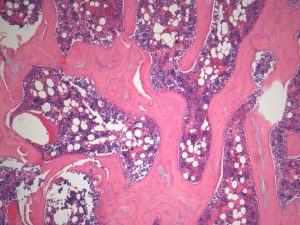 Bone tissue image