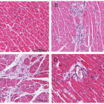 Heart tissue images