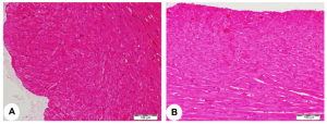 Heart tissue images