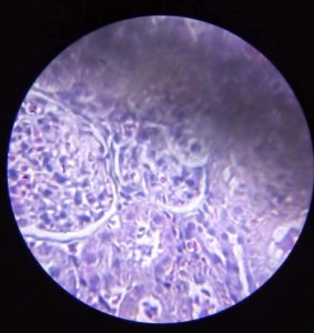 Image of a kidney cell.