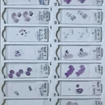 Picture of cell samples.