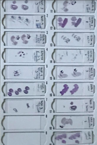 Picture of cell samples.