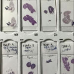 Picture of cell samples.