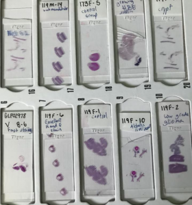 Picture of cell samples.