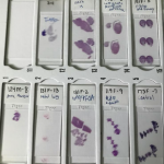 Picture of cell samples.