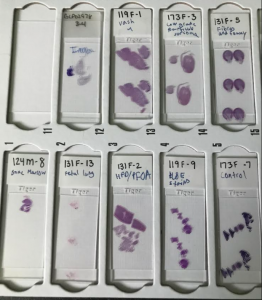 Picture of cell samples.