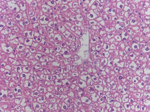 Liver cell