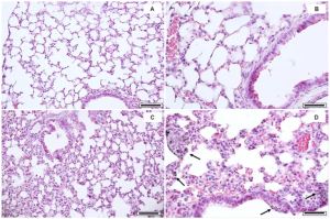 Lung tissue cell image