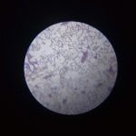 Lung tissue image