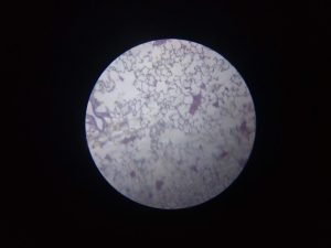 Lung tissue image