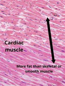 Image of a muscle cell