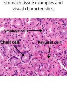 Stomach tissue image.